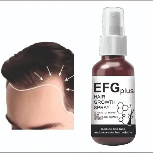 Hair Growth Spray – 50ml (Pack of 2)